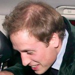 photo showing Prince William's bald spot